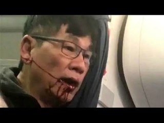 El hombre atacado por United demandará por millones de dólares