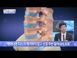 허리 디스크! 제거없이 쉽게 치료하는 수술! [광화문의 아침] 314회 20160909