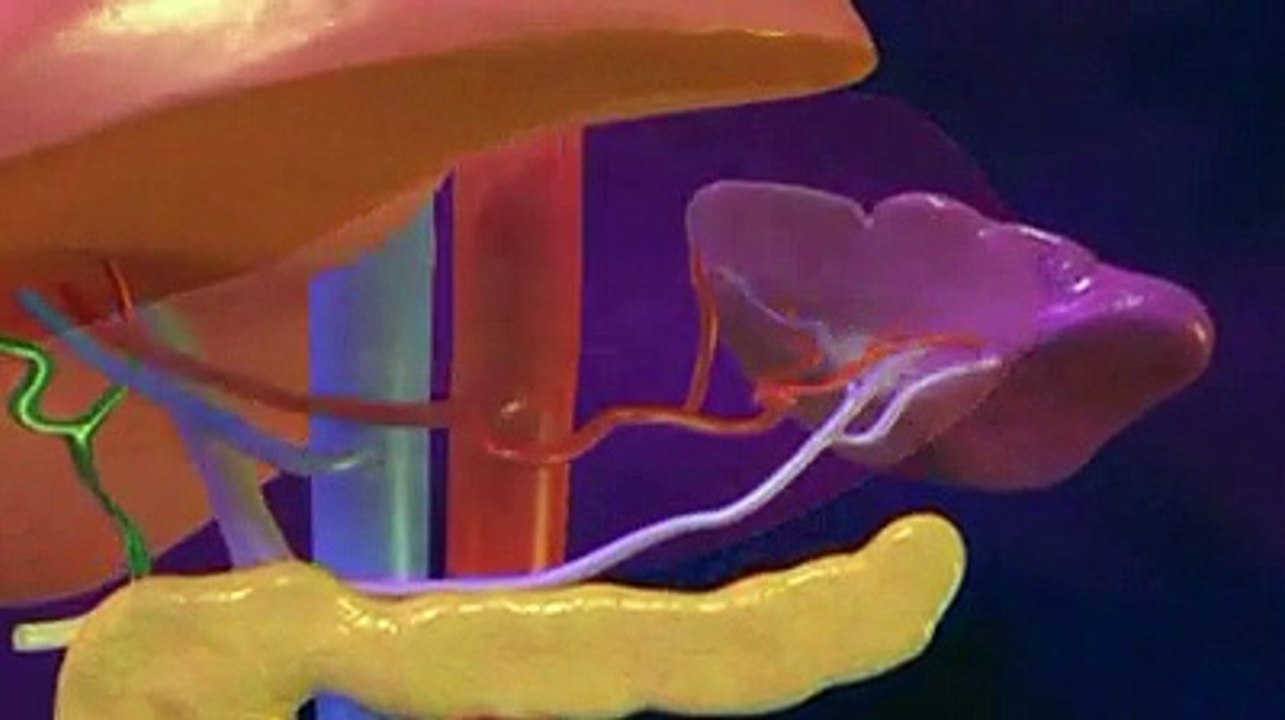 La splénectomie ou ablation chirurgicale de la rate, expliquée en vidéo