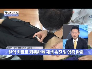‘척추관 협착증’ 한방 치료 방법은? [광화문의 아침] 319회 20160920