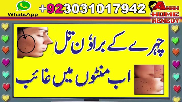 Brown Mole Removal Tips In Urdu Hindi || Chehre K Brown Til Ka Asaan Ilaaj