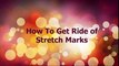 HOW TO GET RIDE OF STRETCH MARKS
