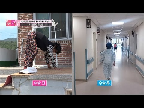 수술 며칠 후, 아직도 절뚝이는 엄마?! [엄마의 봄날] 58회 20160911