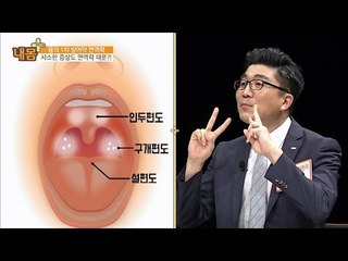 편도염, 다래끼, 예민함은 면역력 저하의 신호! [내 몸 플러스] 22회 20160904