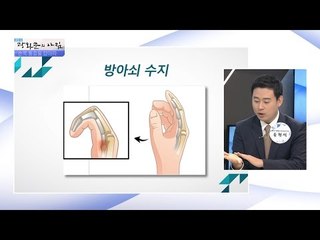 손목 통증을 일으키는 질환이 있다?! [광화문의 아침] 306회 20160830