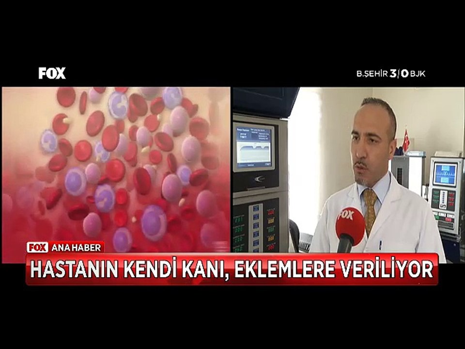 Eklem ağrıları ve Kireçlenmeye karşı kök hücre tedavisi