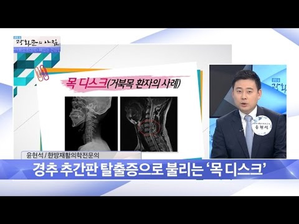 허리 디스크보다 위험한 ‘목 디스크’ [광화문의 아침] 296회 20160816