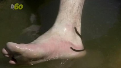 Russia is so Broke Doctors are Treating People With Leeches