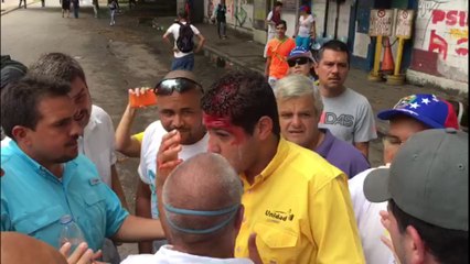 Agreden a diputado Olivares con una lacrimógena