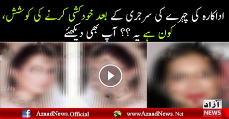 This Actress Tried Suicide After Her Plastic Surgery