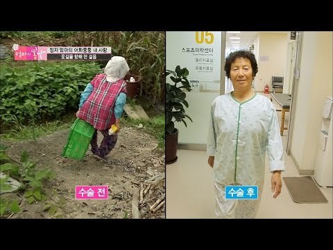 수술 후, 엄마의 허리 상태는? [엄마의 봄날] 53회 20160807