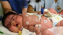 Acaba De Nacer El bebe mas grande del mundo!