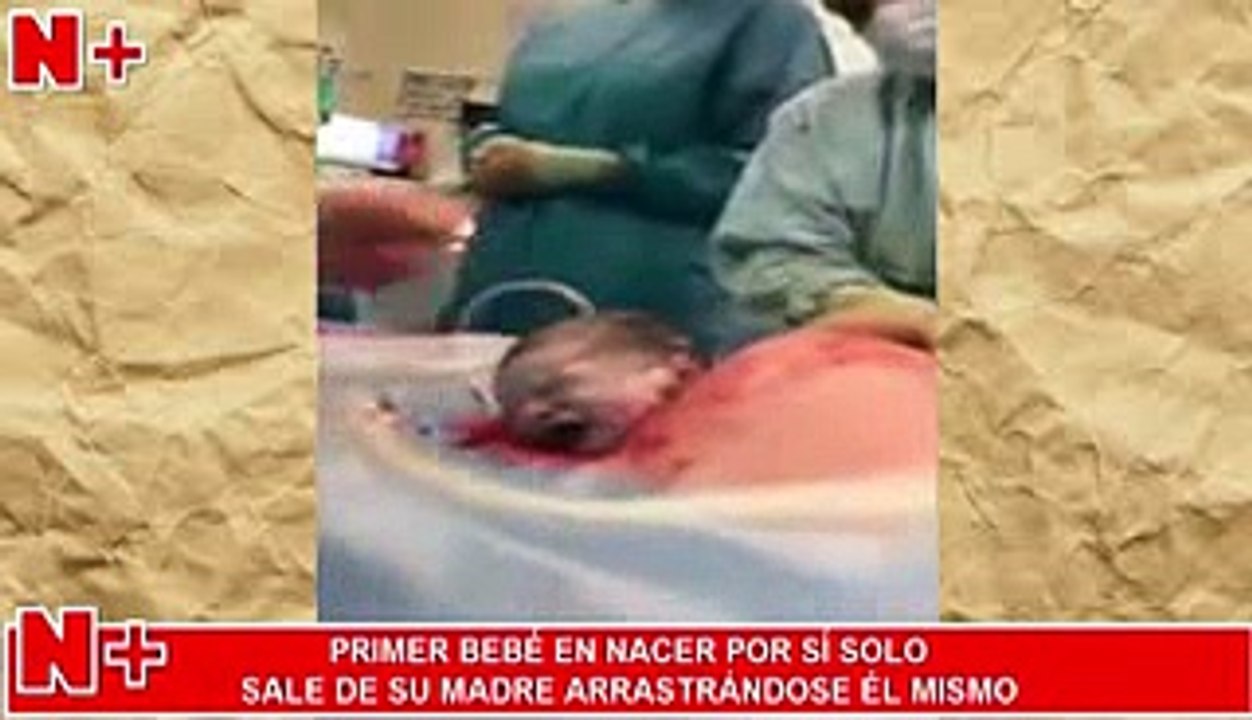 Primer bebe en Nacer por si solo sin Ayuda de Nadie