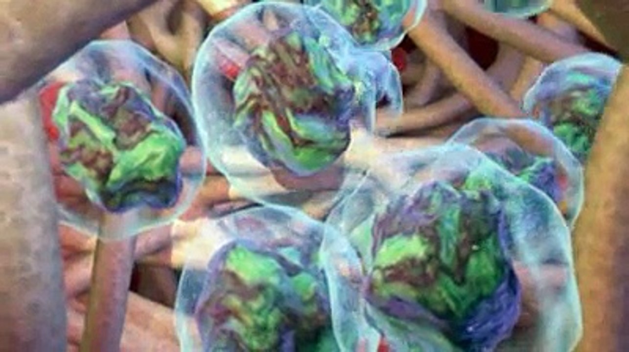 Chimiothérapie