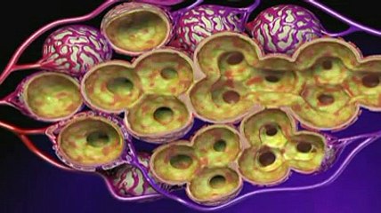 La pneumonie expliquée en vidéo