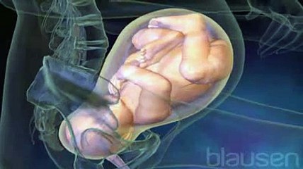 Anesthésie péridurale