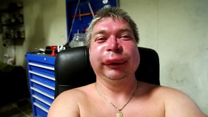 10 MORDIDAS E PICADAS MAIS DOLORIDAS DO MUNDO