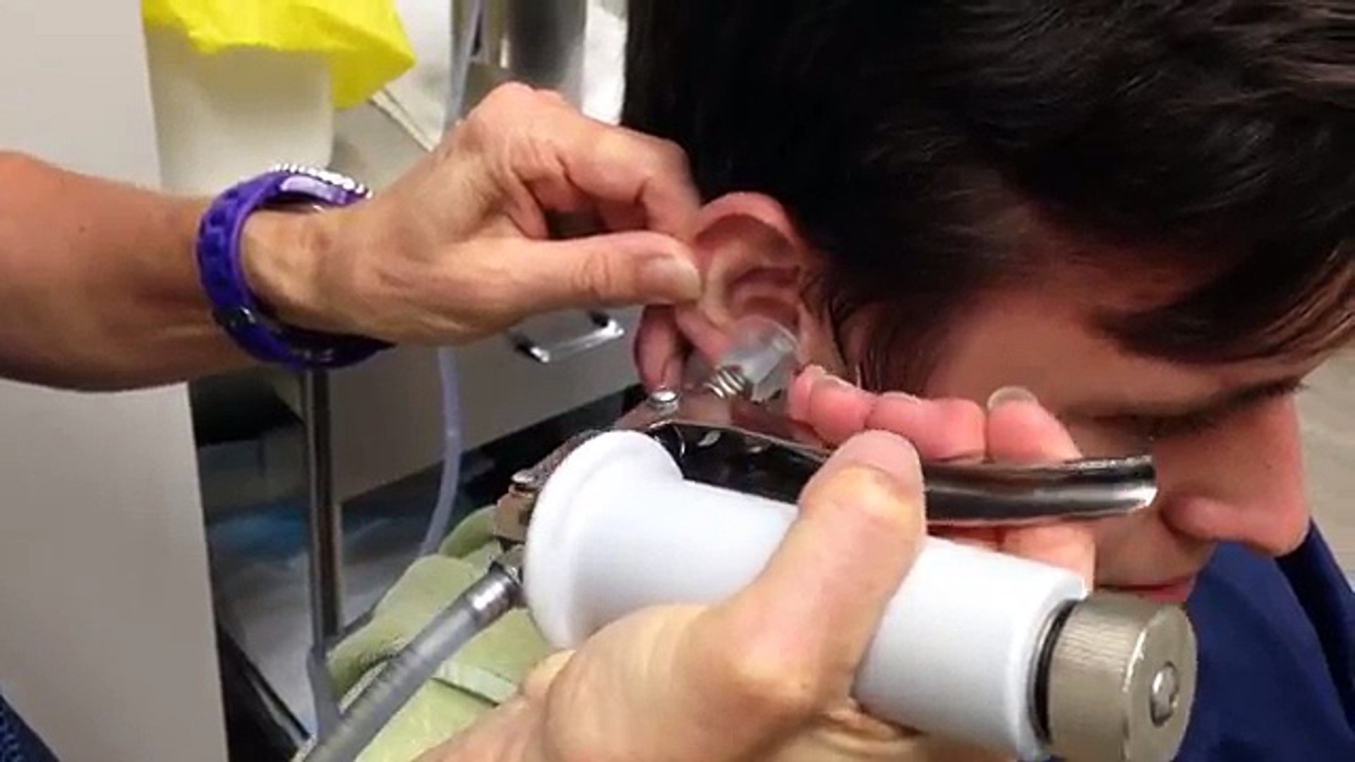 Ce spécialiste injecte de l'eau dans l'oreille de son patient. Ce qu'il va  en ressortir est inimaginable ! - Vidéo Dailymotion