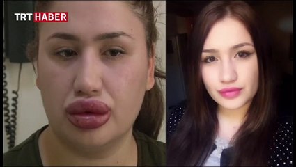 Daha güzel olmak istemişti, sonucu böyle oldu