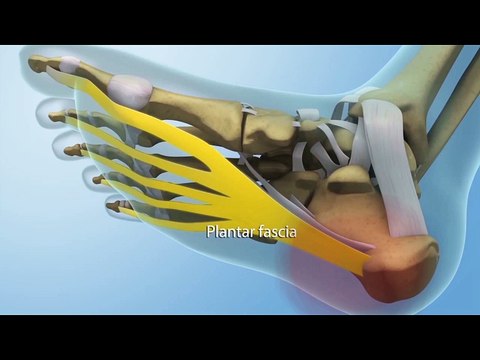 How to Tell the Difference: Plantar Fasciitis vs. Achilles Tendinitis