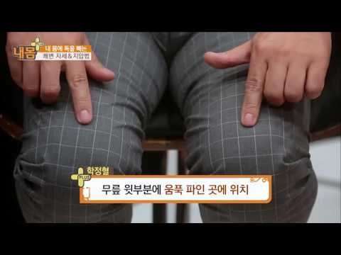 변비 격파! ‘쾌변 자세’를 알아보자! [내 몸 플러스] 17회 20160731