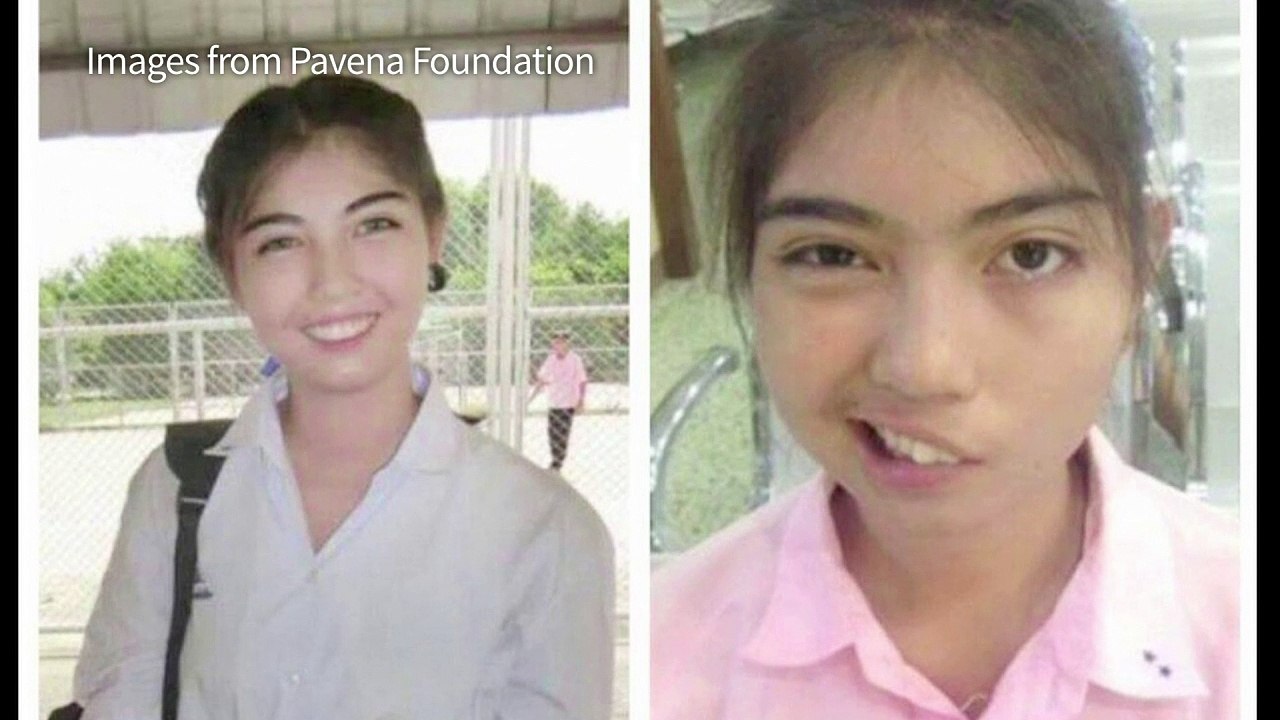 Thai schoolgirl learns to smile again after teacher assault