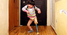 Antalya 150 Liraya Mal Ettiği Düzenekle Tek Bacaklı Kızına Yürümeyi Öğretiyor