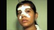 National level woman Kabaddi player beaten up for resisting molestation