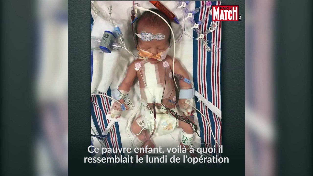Jimmy Kimmel, son fils et son engagement pour l'Obamacare