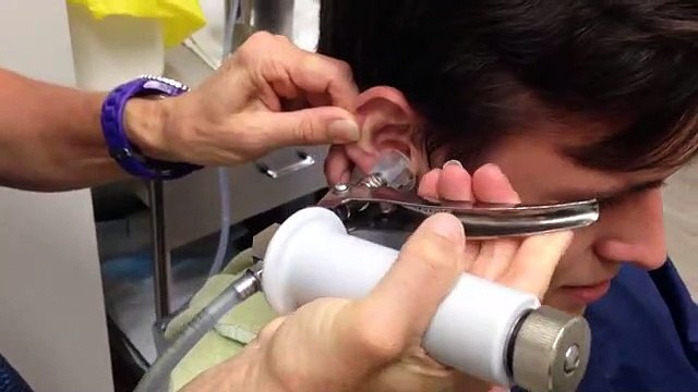 Quand tu sors ça d'une oreille t'es pas bien... Horrible, le cauchemar