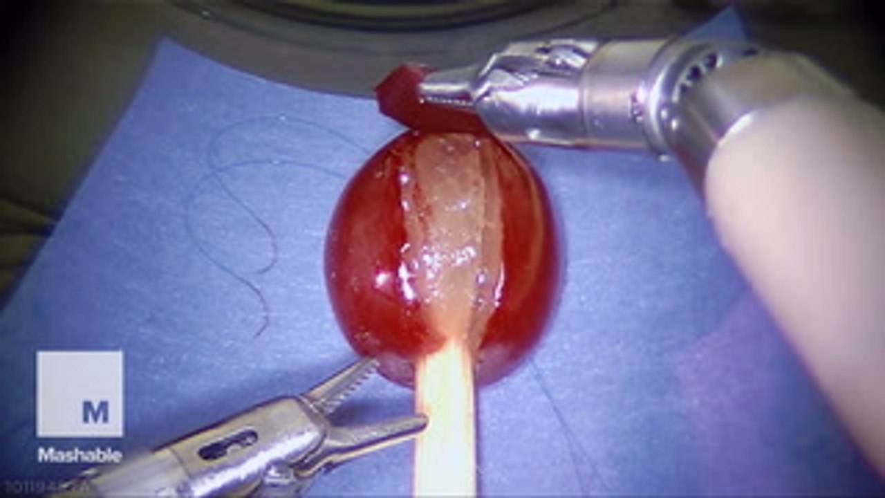 Super precise robot can stitch a grape's skin back together