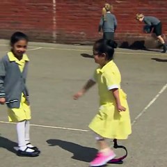 Une petite fille montre sa prothèse de jambe à ses amies