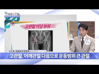 고관절 어떤 뼈일까? [광화문의 아침] 262회 20160628