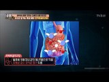 유산균 잘 먹는 특급 비법! [내 몸 사용설명서] 152회 20170505