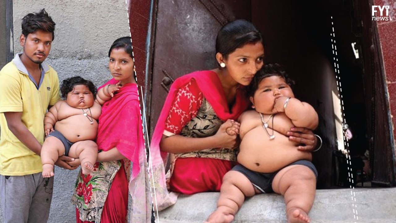 Obese 1-Year-Old