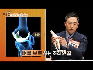 3mm의 연골을 지켜라! [내 몸 플러스] 10회 20160612
