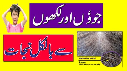 Lice On Hair || Lice On Hair Shaft || Sir Ki Juon Se Nijat In Urdu | Hindi
