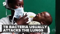 How Come Tuberculos  Problem_ _ 30 STK _ NBC News