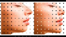 Maxillofacial surgeons | plastic surgeons |  Don’t Regret Your Surgery | Analysis your face before surgery