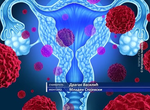 Svetski dan borbe protiv raka jajnika, 8. maj 2017. (RTV Bor)