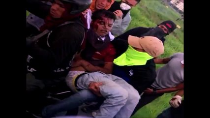 La #GNB remata a joven venezolano después de herido por un #paramilitar-1