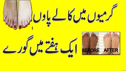Whtening Dark Feet Tips For Summer || Feet Whitening Tips In Urdu
