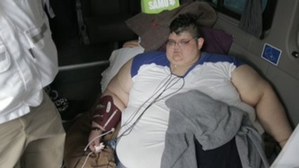 El hombre más obeso del mundo se prepara para su operación tranquilo y motivado