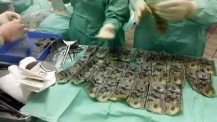 Une femme manque de mourir en avalant 7000 dollars