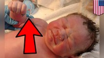 Bayi baru lahir difoto memegang alat kontrasepsi ibunya - Tomonews
