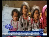 غرفة الأخبار | اليونسيف : انتهاكات جسيمة ضد أطفال اليمن خلال العام الماضي
