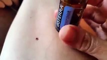 Ticks do not like 'Peppermint' - Watch tick trying to flee.