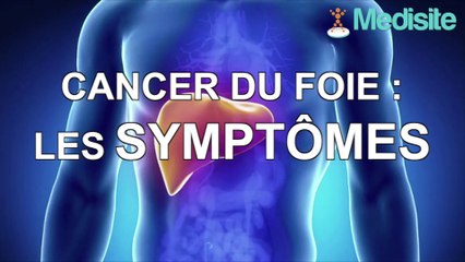 Cancer du foie : les symptômes