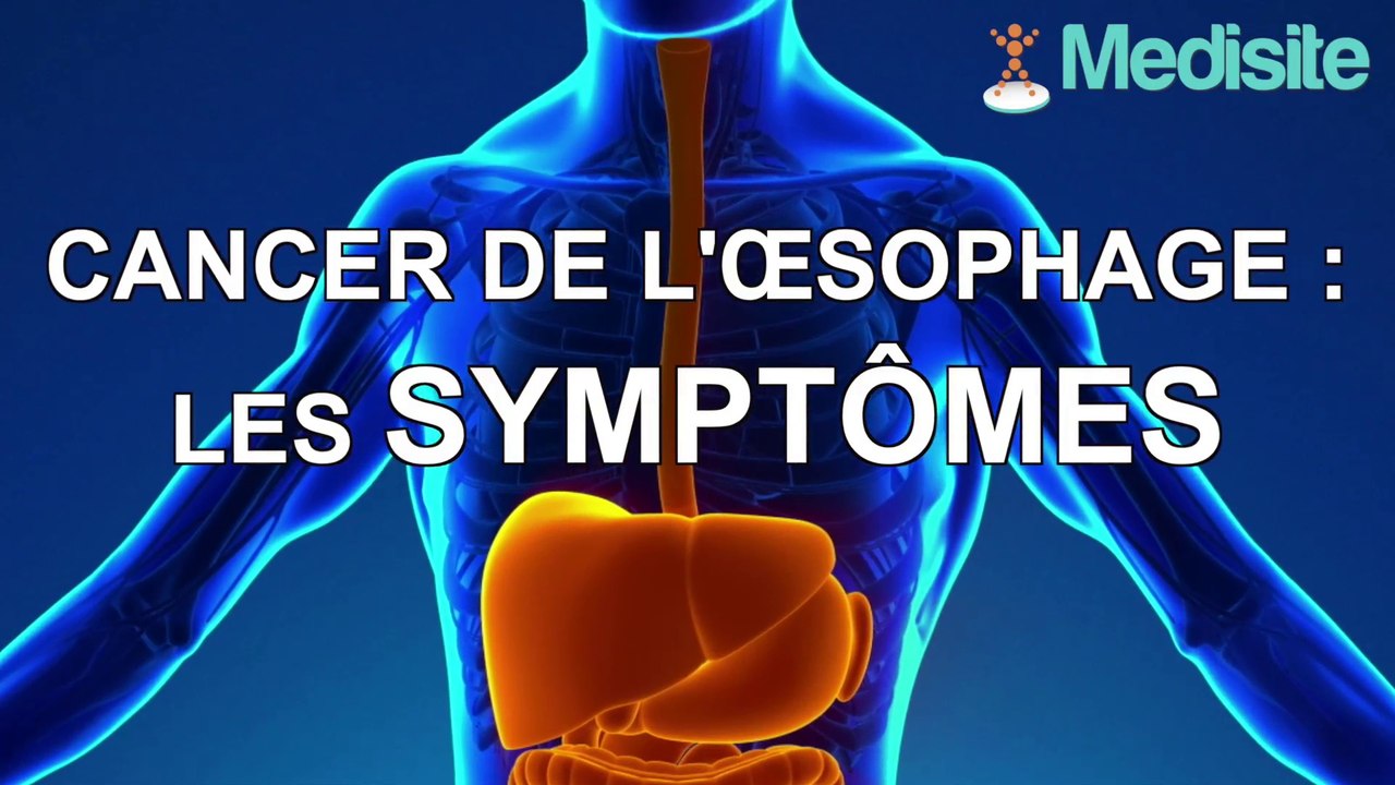 Cancer de l'œsophage : les symptômes - Vidéo Dailymotion