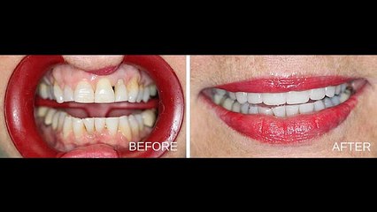 Atlanta Cosmetic Dentist Office Near Me